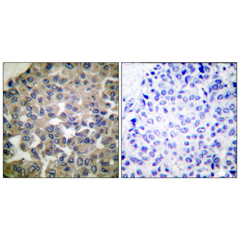 Immunohistochemistry - Anti-PLCG1 Antibody (B0079) - Antibodies.com