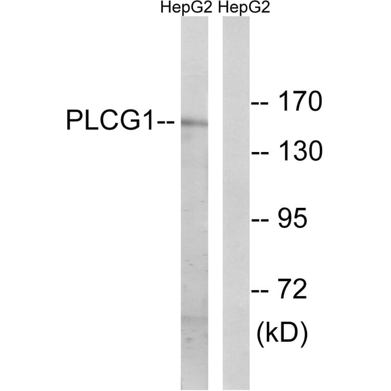 Western Blot - Anti-PLCG1 Antibody (B0079) - Antibodies.com