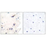 Immunohistochemistry - Anti-PLCB3 Antibody (B0078) - Antibodies.com