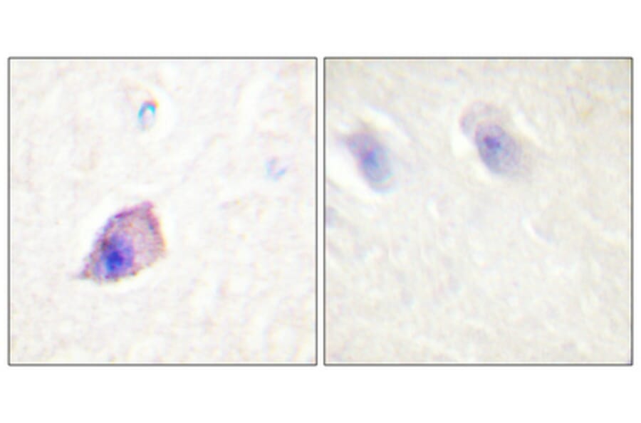 Immunohistochemistry - Anti-PLCB3 Antibody (B0078) - Antibodies.com