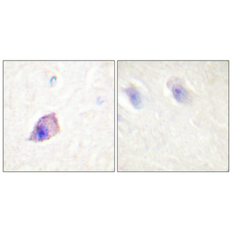 Immunohistochemistry - Anti-PLCB3 Antibody (B0078) - Antibodies.com