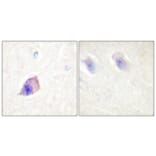 Immunohistochemistry - Anti-PLCB3 Antibody (B0078) - Antibodies.com