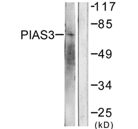 Western Blot - Anti-PIAS3 Antibody (C0363) - Antibodies.com