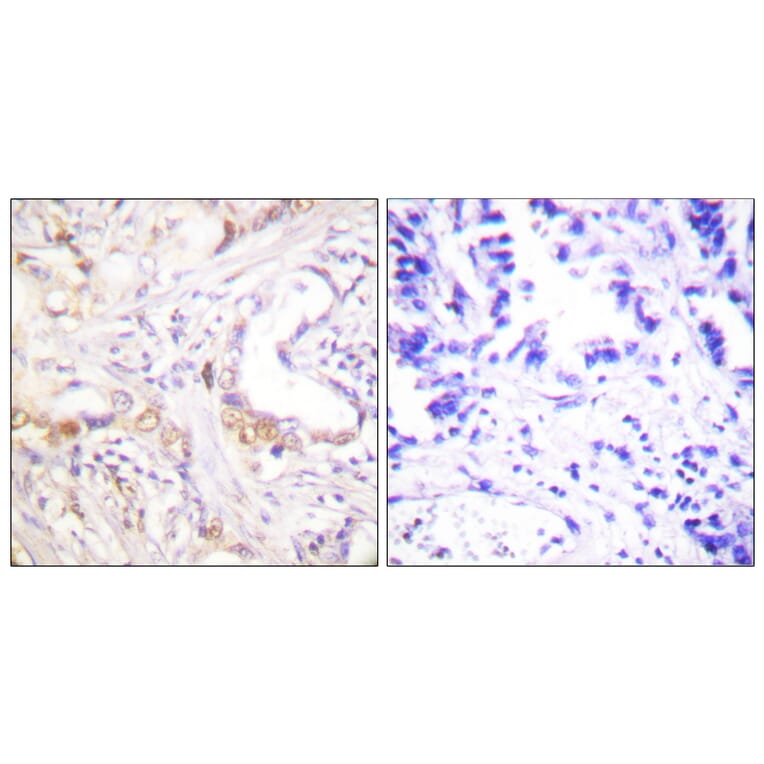 Immunohistochemistry - Anti-PIAS3 Antibody (C0363) - Antibodies.com