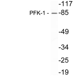 Western Blot - Anti-PFK-1 Antibody (R12-2302) - Antibodies.com