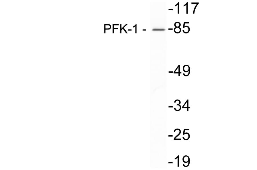 Western Blot - Anti-PFK-1 Antibody (R12-2302) - Antibodies.com
