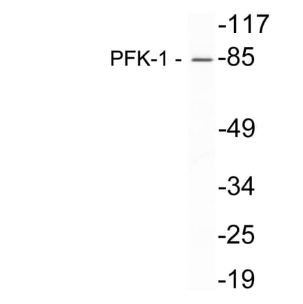 Western Blot - Anti-PFK-1 Antibody (R12-2302) - Antibodies.com