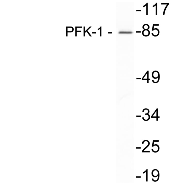 Western Blot - Anti-PFK-1 Antibody (R12-2302) - Antibodies.com