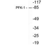 Western Blot - Anti-PFK-1 Antibody (R12-2302) - Antibodies.com