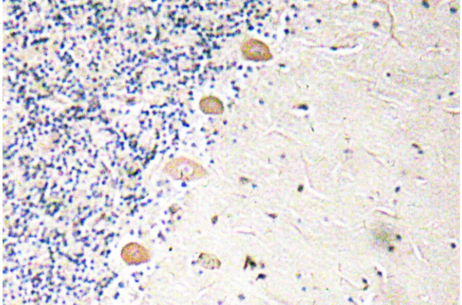 Immunohistochemistry - Anti-PFK-1 Antibody (R12-2302) - Antibodies.com