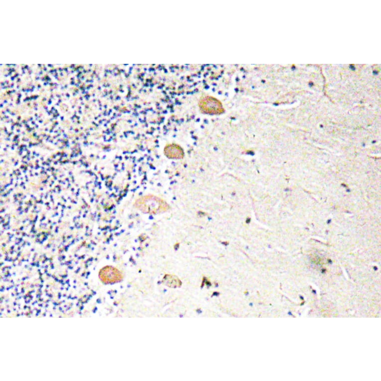 Immunohistochemistry - Anti-PFK-1 Antibody (R12-2302) - Antibodies.com