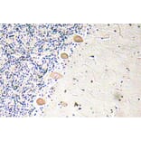 Immunohistochemistry - Anti-PFK-1 Antibody (R12-2302) - Antibodies.com