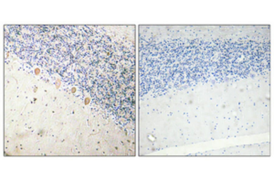 Immunohistochemistry - Anti-PFK-1 Antibody (R12-2302) - Antibodies.com