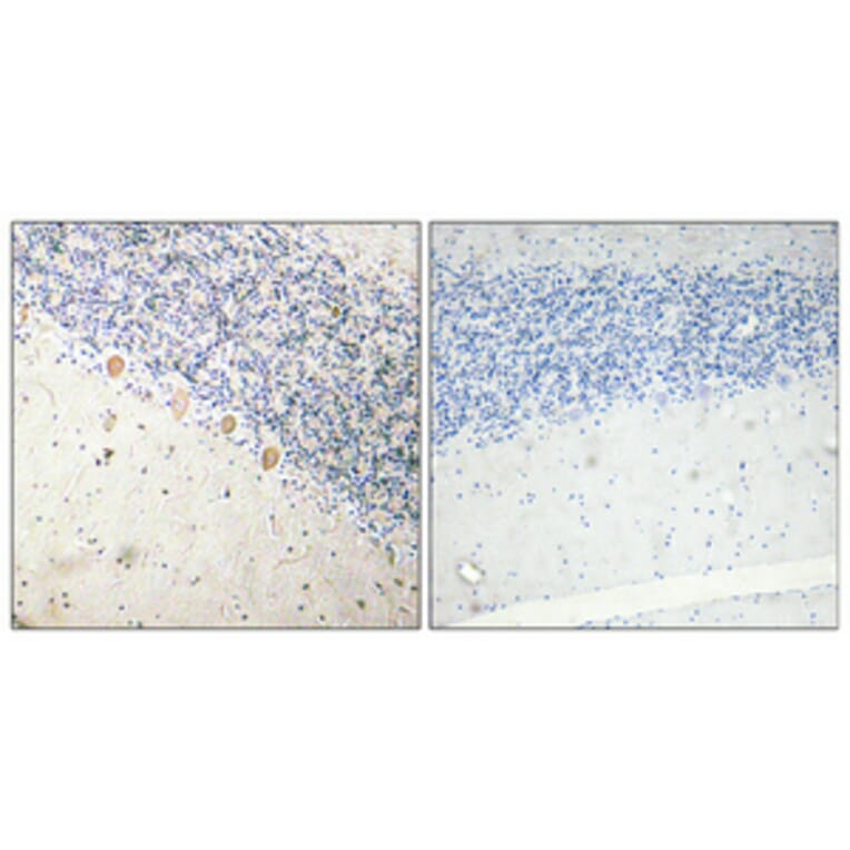 Immunohistochemistry - Anti-PFK-1 Antibody (R12-2302) - Antibodies.com