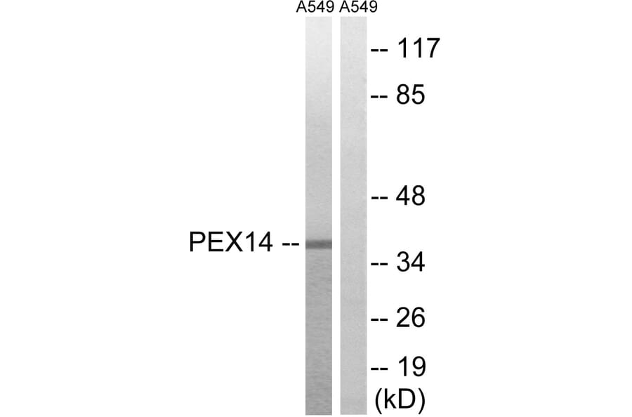 Western Blot - Anti-PEX14 Antibody (C17635) - Antibodies.com