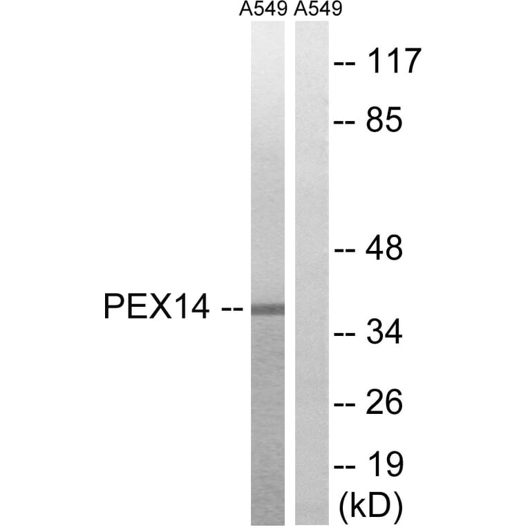 Western Blot - Anti-PEX14 Antibody (C17635) - Antibodies.com