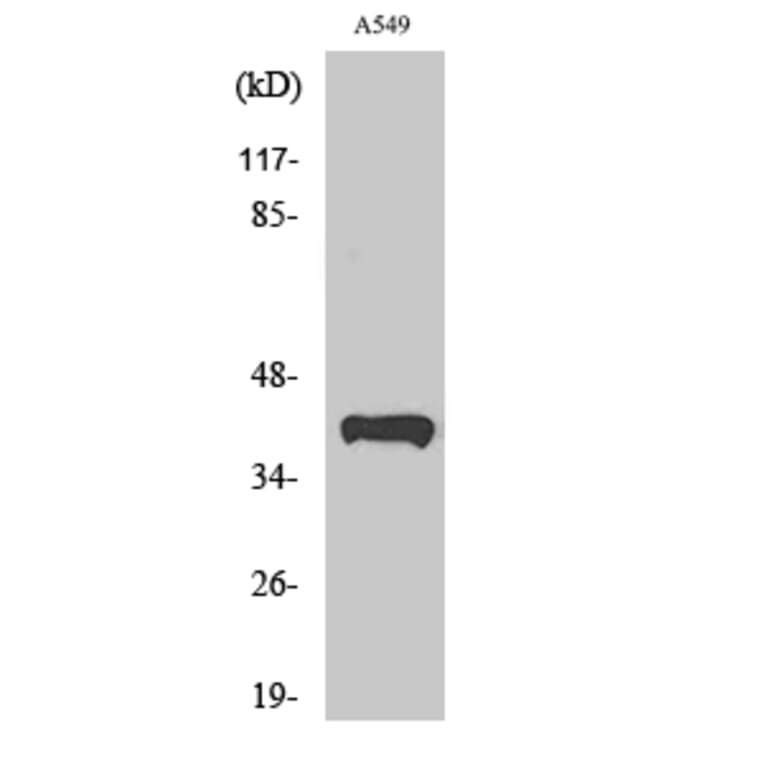 Western Blot - Anti-PEX14 Antibody (C17635) - Antibodies.com