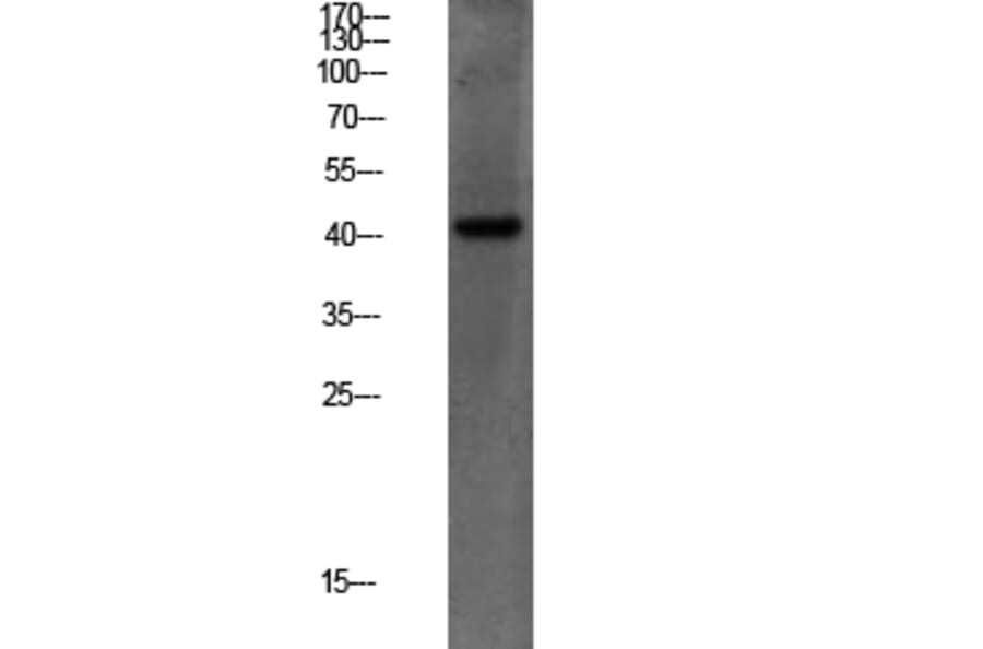 Western Blot - Anti-PEX14 Antibody (C17635) - Antibodies.com