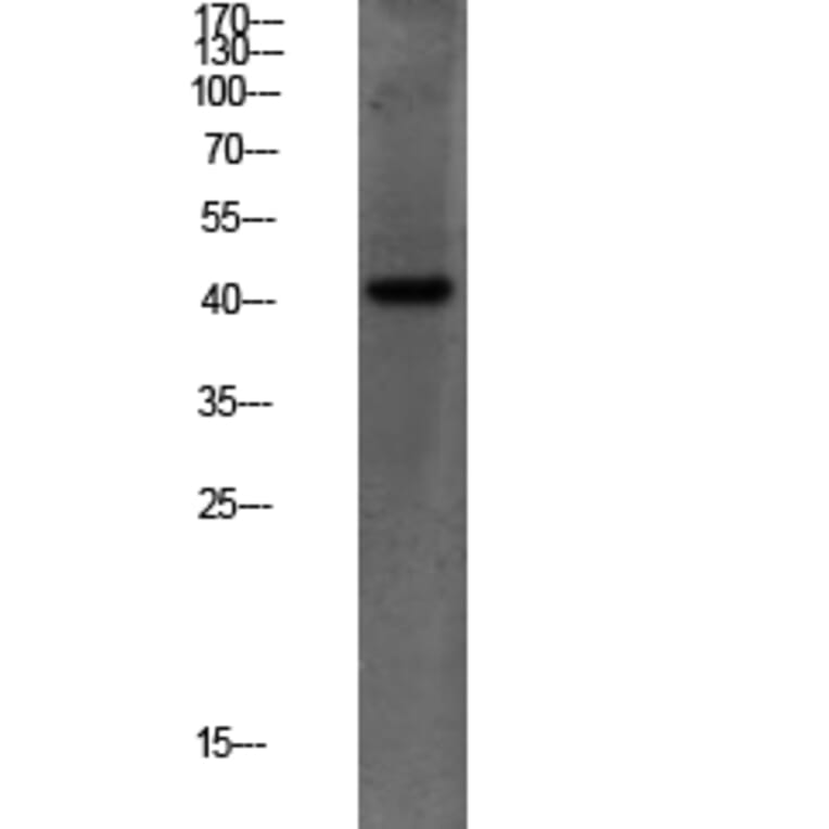 Western Blot - Anti-PEX14 Antibody (C17635) - Antibodies.com