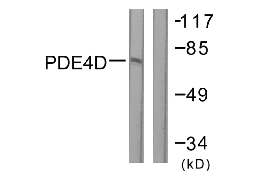 Western Blot - Anti-PDE4D Antibody (B0543) - Antibodies.com