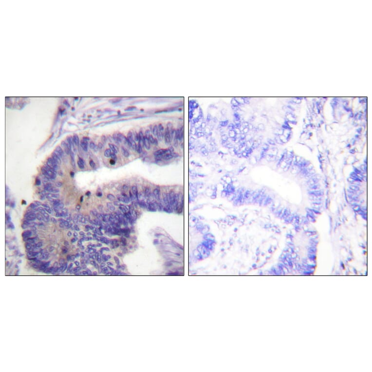 Immunohistochemistry - Anti-PDE4D Antibody (B0543) - Antibodies.com