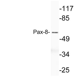 Western Blot - Anti-Pax-8 Antibody (R12-2294) - Antibodies.com