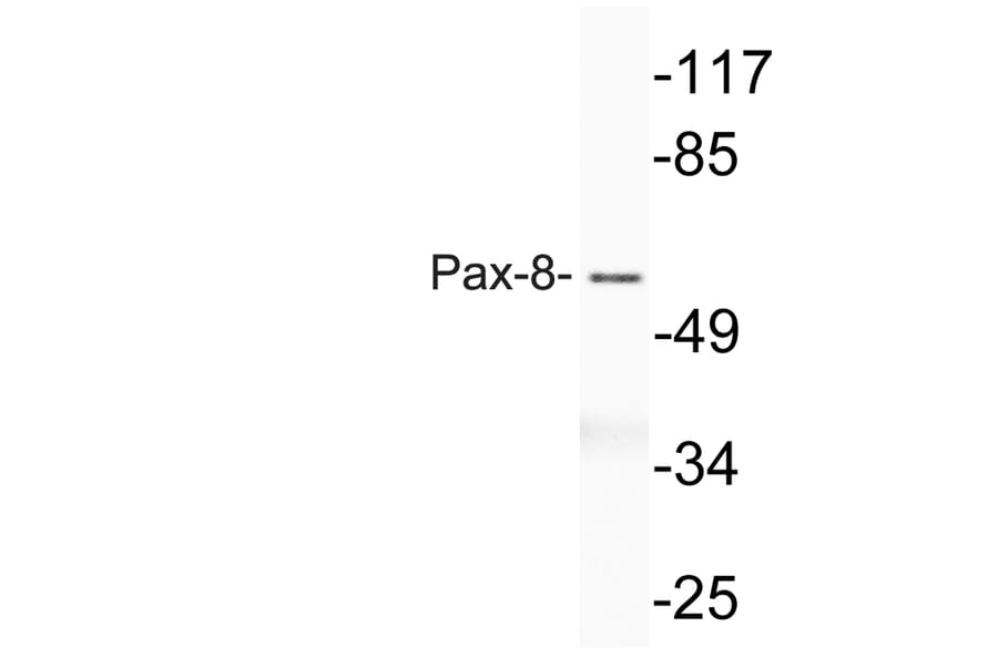 Western Blot - Anti-Pax-8 Antibody (R12-2294) - Antibodies.com