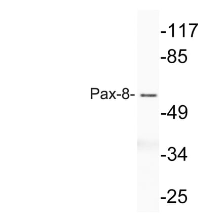 Western Blot - Anti-Pax-8 Antibody (R12-2294) - Antibodies.com