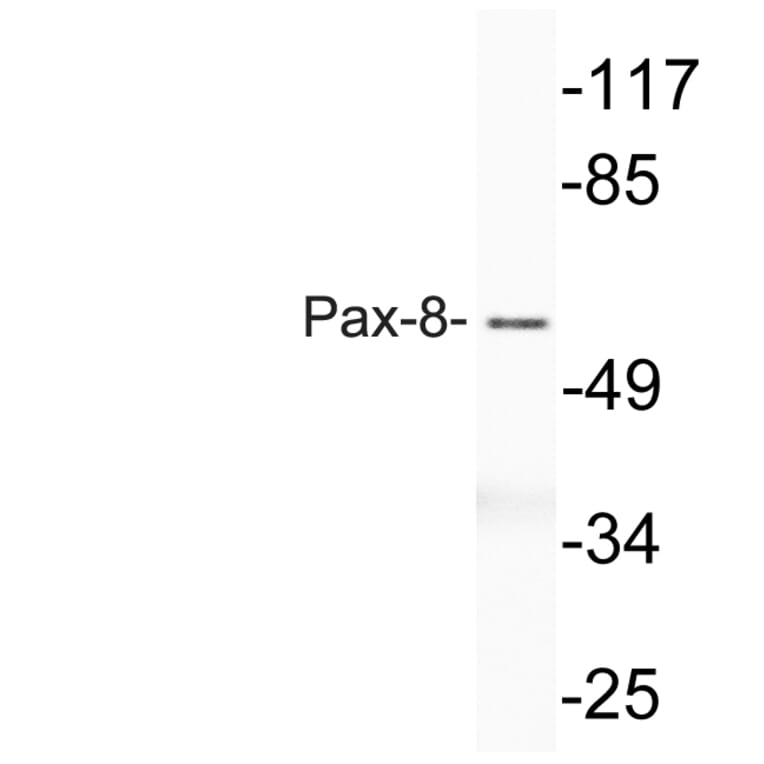 Western Blot - Anti-Pax-8 Antibody (R12-2294) - Antibodies.com