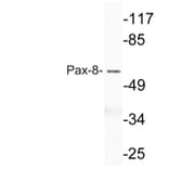 Western Blot - Anti-Pax-8 Antibody (R12-2294) - Antibodies.com