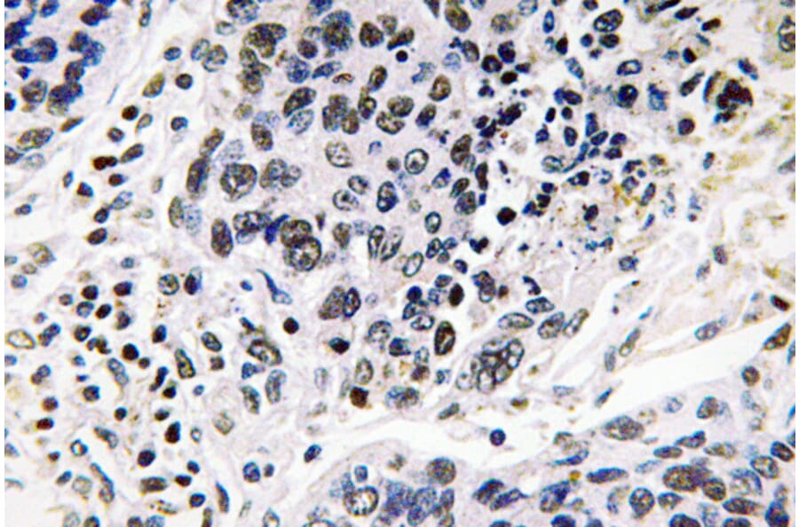 Immunohistochemistry - Anti-Pax-8 Antibody (R12-2294) - Antibodies.com