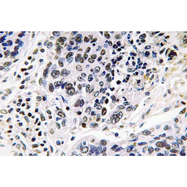 Immunohistochemistry - Anti-Pax-8 Antibody (R12-2294) - Antibodies.com