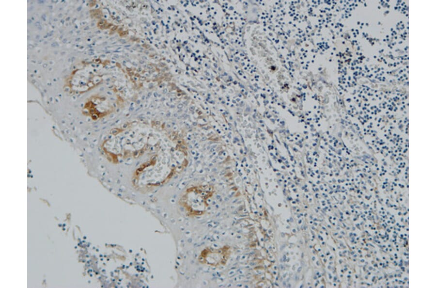 Immunohistochemistry - Anti-Pax-8 Antibody (R12-2294) - Antibodies.com