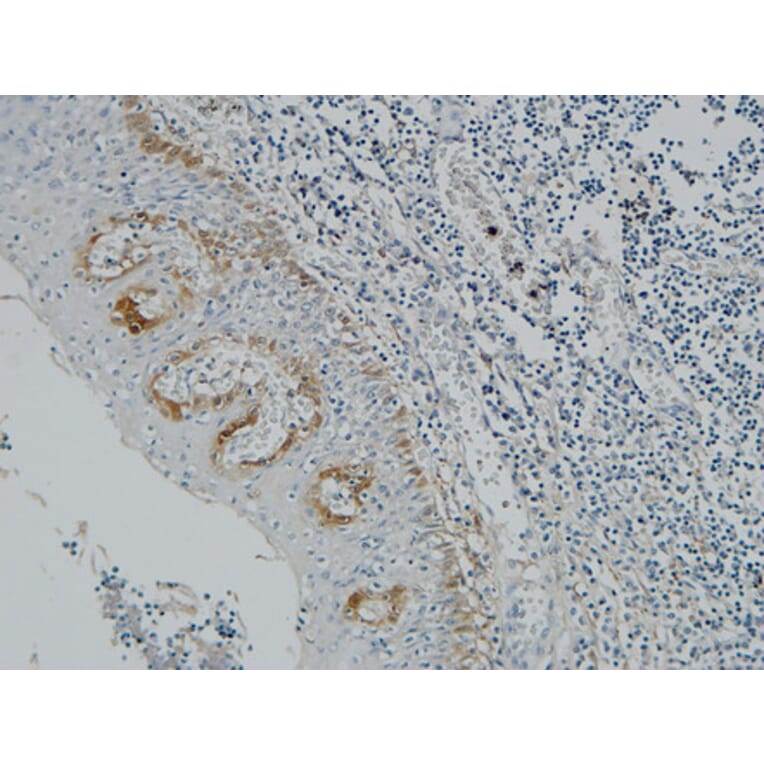 Immunohistochemistry - Anti-Pax-8 Antibody (R12-2294) - Antibodies.com