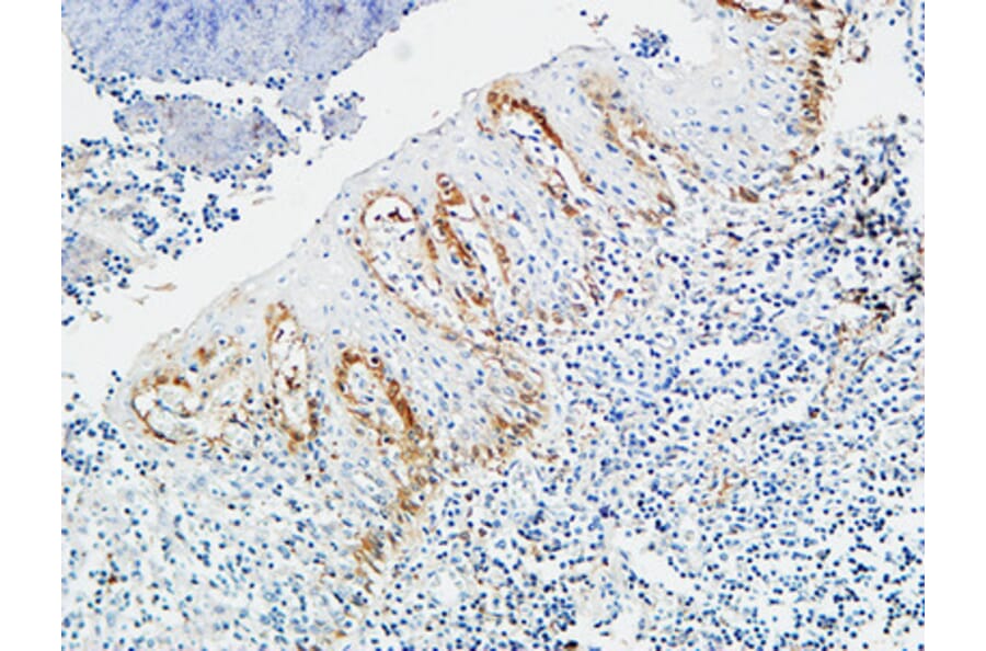 Immunohistochemistry - Anti-Pax-8 Antibody (R12-2294) - Antibodies.com