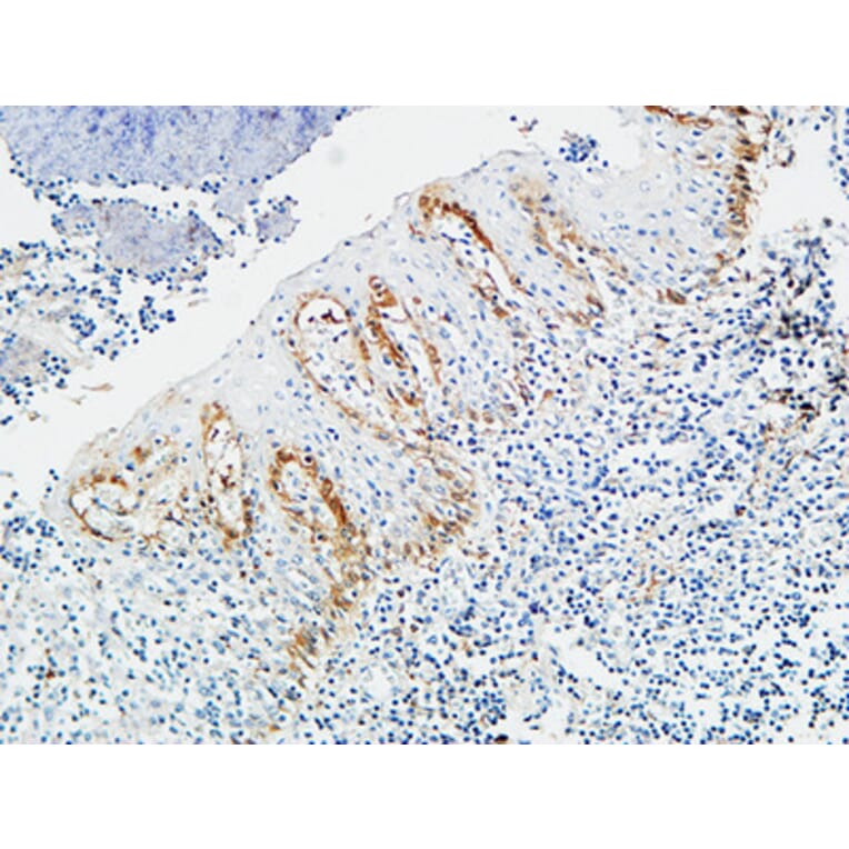 Immunohistochemistry - Anti-Pax-8 Antibody (R12-2294) - Antibodies.com