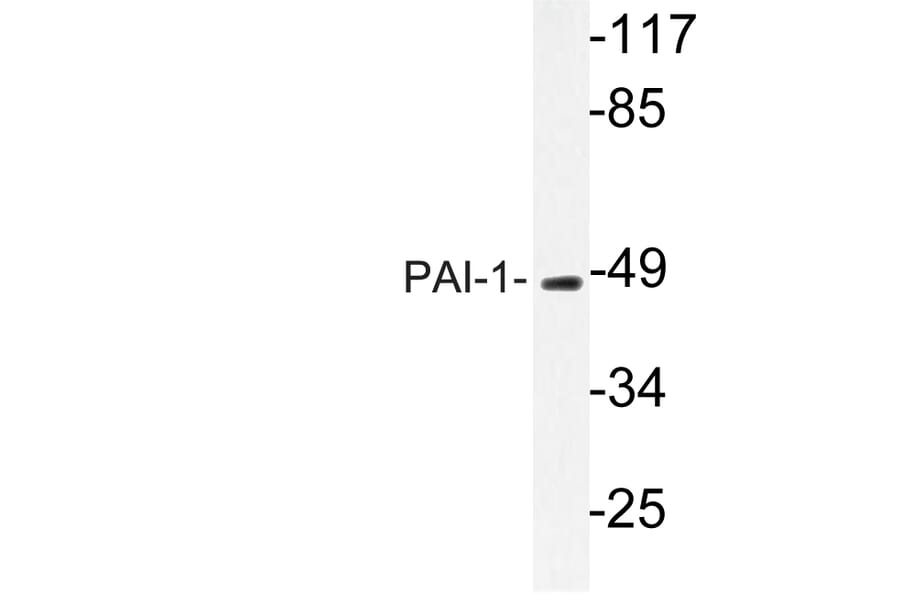 Western Blot - Anti-PAI-1 Antibody (R12-2288) - Antibodies.com