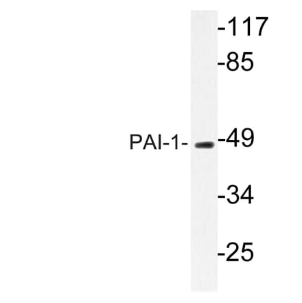 Western Blot - Anti-PAI-1 Antibody (R12-2288) - Antibodies.com