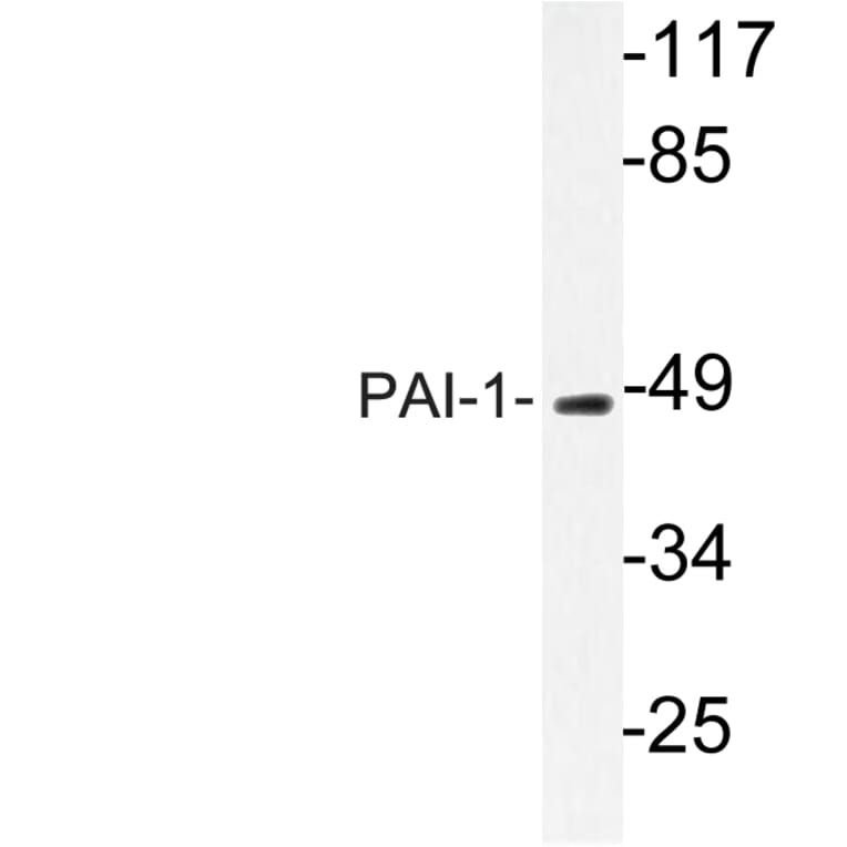 Western Blot - Anti-PAI-1 Antibody (R12-2288) - Antibodies.com