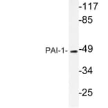 Western Blot - Anti-PAI-1 Antibody (R12-2288) - Antibodies.com