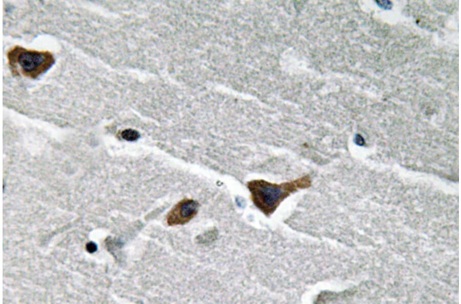 Immunohistochemistry - Anti-PAI-1 Antibody (R12-2288) - Antibodies.com