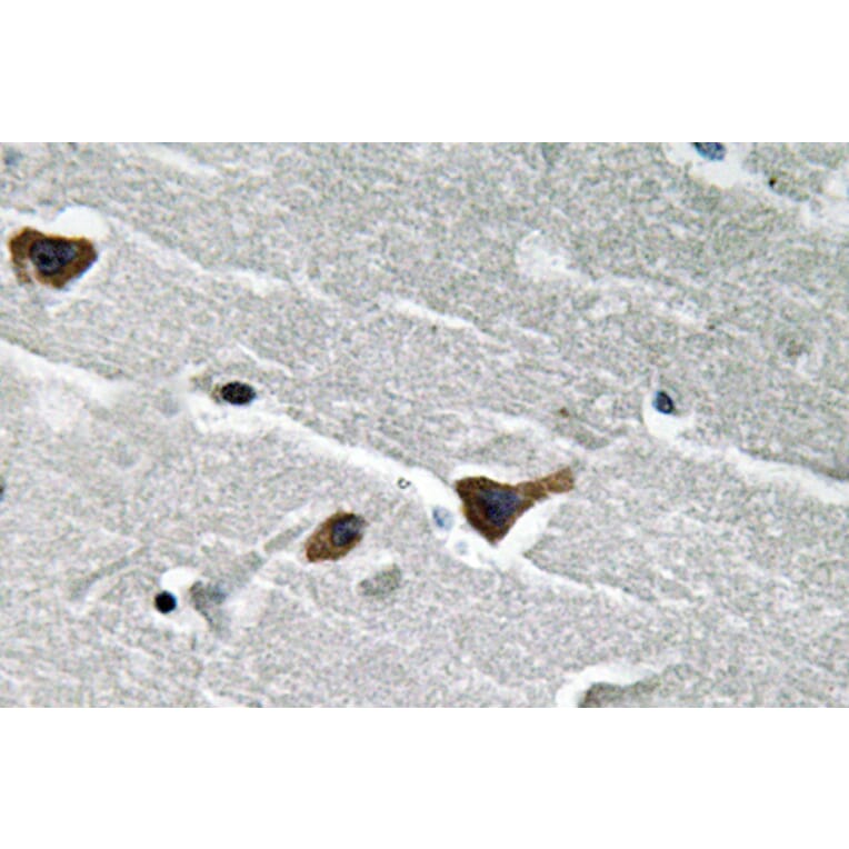 Immunohistochemistry - Anti-PAI-1 Antibody (R12-2288) - Antibodies.com