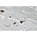 Immunohistochemistry - Anti-PAI-1 Antibody (R12-2288) - Antibodies.com