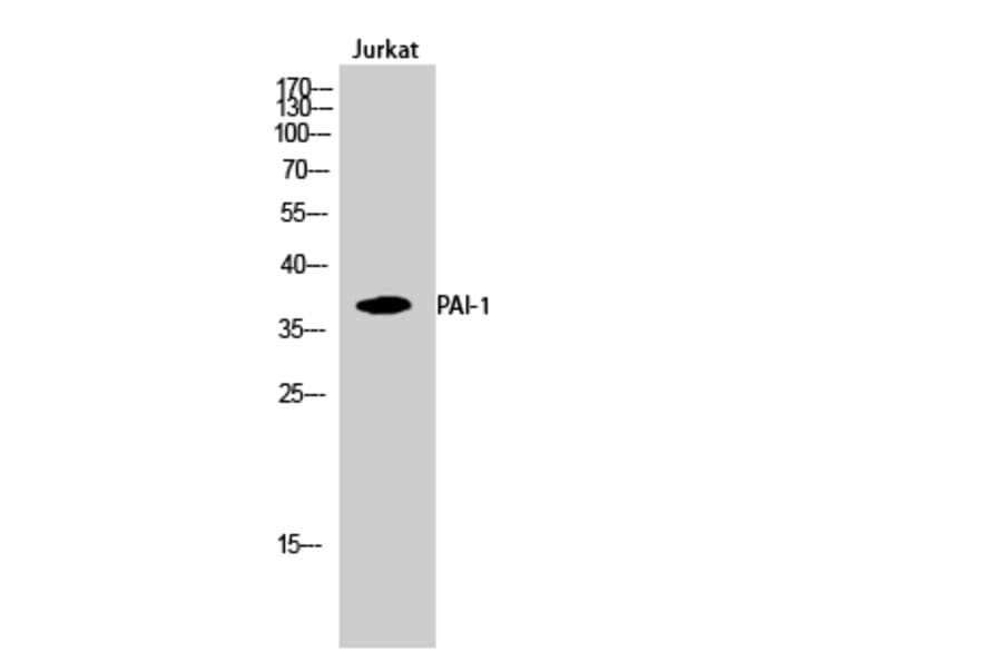 Western Blot - Anti-PAI-1 Antibody (R12-2288) - Antibodies.com
