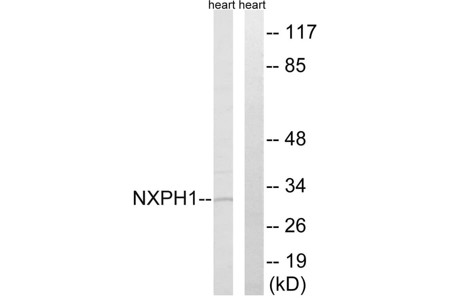 Western Blot - Anti-NXPH1 Antibody (C16915) - Antibodies.com