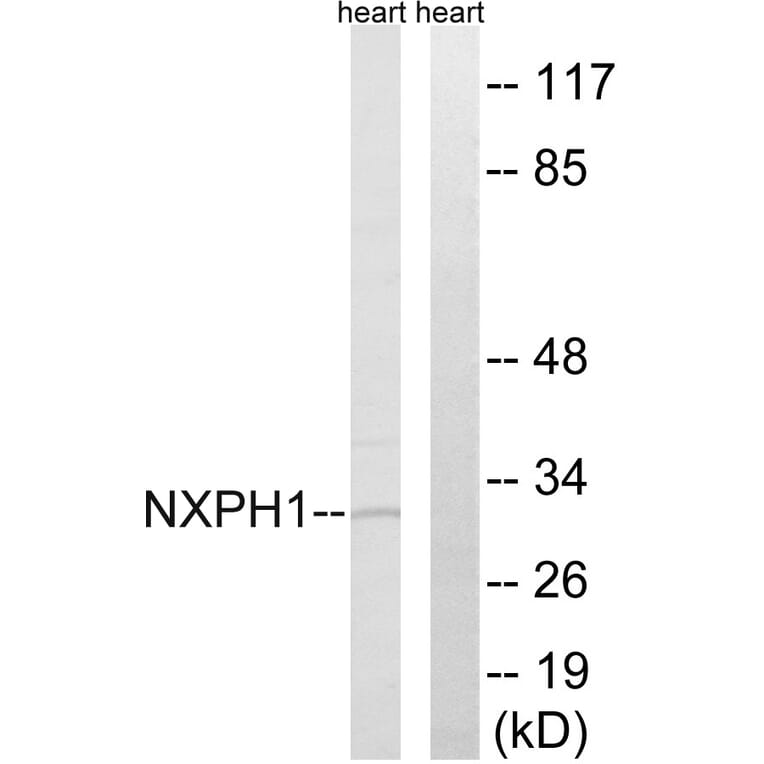 Western Blot - Anti-NXPH1 Antibody (C16915) - Antibodies.com