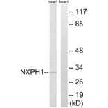 Western Blot - Anti-NXPH1 Antibody (C16915) - Antibodies.com