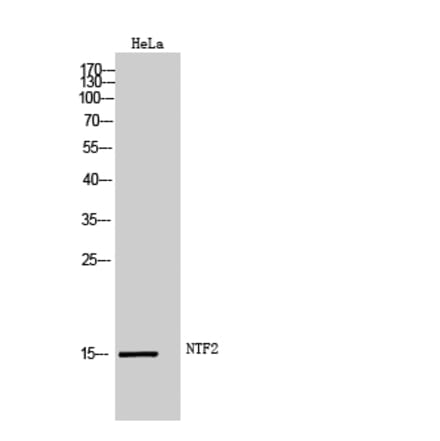 Western Blot - Anti-NUTF2 Antibody (C17138) - Antibodies.com