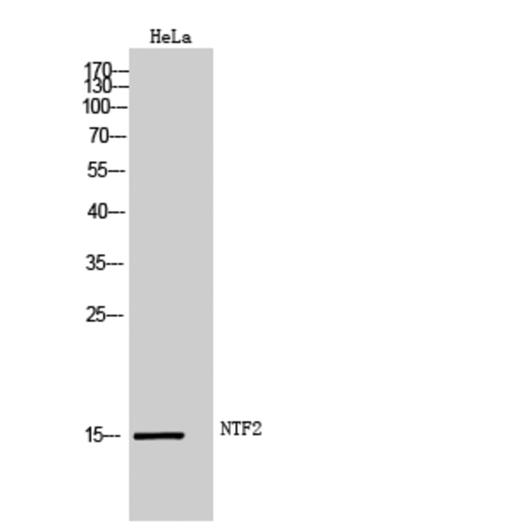 Western Blot - Anti-NUTF2 Antibody (C17138) - Antibodies.com