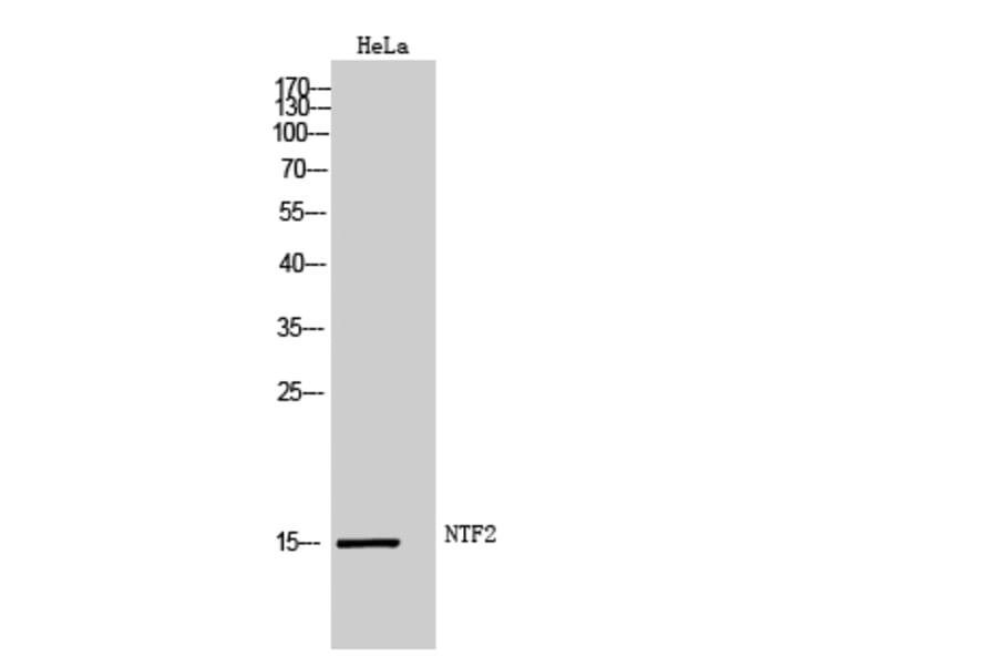 Western Blot - Anti-NUTF2 Antibody (C17138) - Antibodies.com